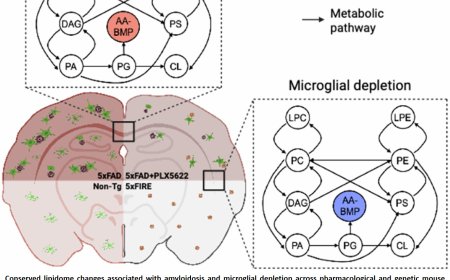 Targeting brain immune cells could restore Alzheimer’s-related lipid imbalance