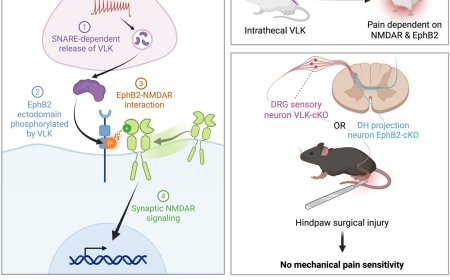 A new on-switch for pain signaling pathway