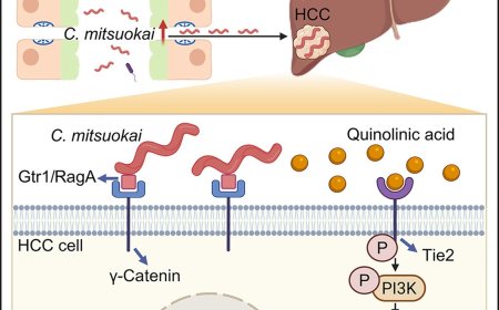 Mechanism of hepatocellular carcinogenesis from Catenibacterium mitsuokai