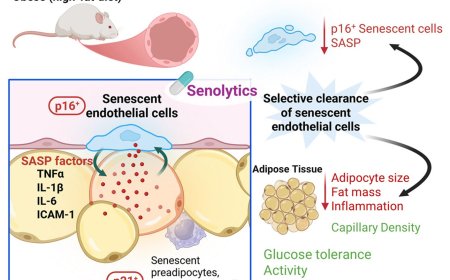 Aged blood vessel cells drive metabolic diseases