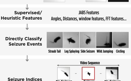 Visual detection of seizures in mice using supervised machine learning
