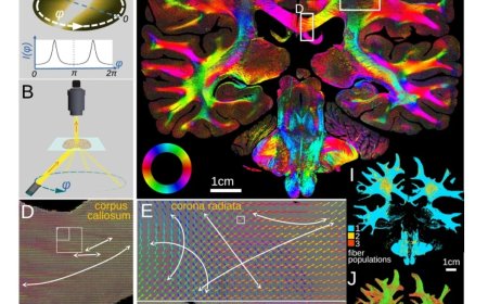 Micron-resolution fiber mapping in histology independent of sample preparation