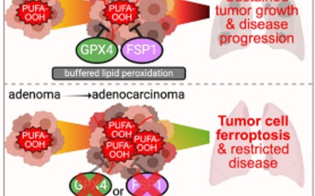 Targeting FSP1 triggers ferroptosis in lung cancer