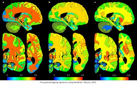 A new atlas of the human brain