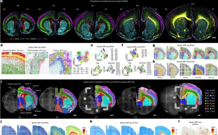 How the brain develops and resolves inflammation