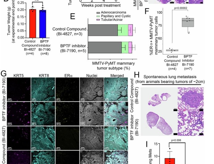 Loss of transcription factor suppresses metastasis of mammary tumors