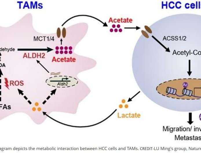 Acetate from tumor-associated macrophages fuels liver cancer metastasis
