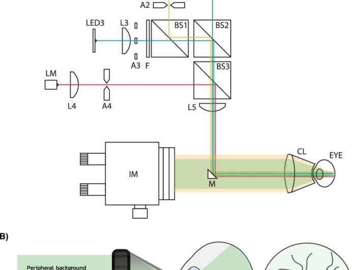 New dry macular degeneration treatment 