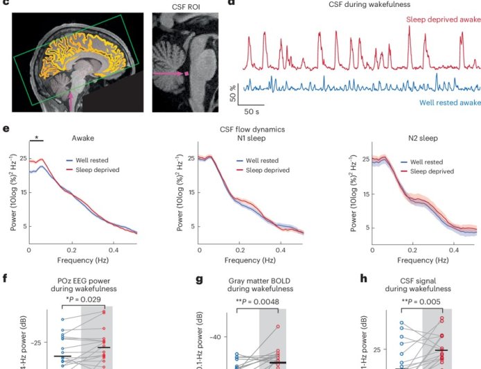 Brain without sleep!