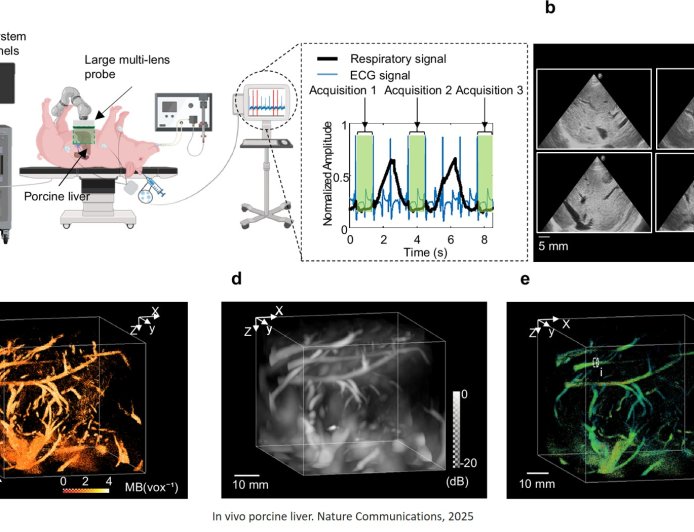 Imaging microvasculature of an entire organ using ultrasound in 4D