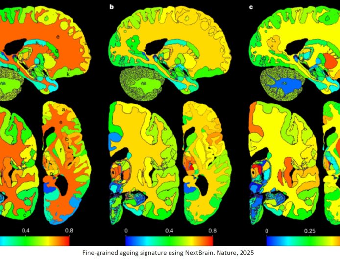 A new atlas of the human brain