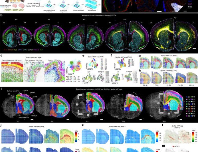 How the brain develops and resolves inflammation