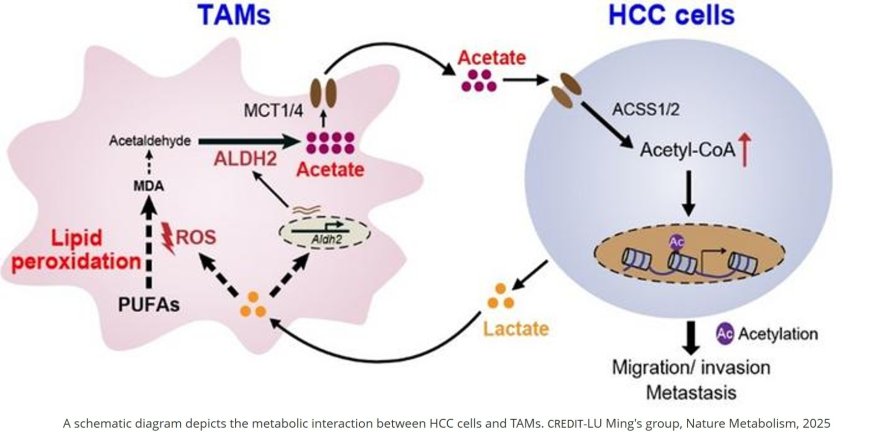 Acetate from tumor-associated macrophages fuels liver cancer metastasis