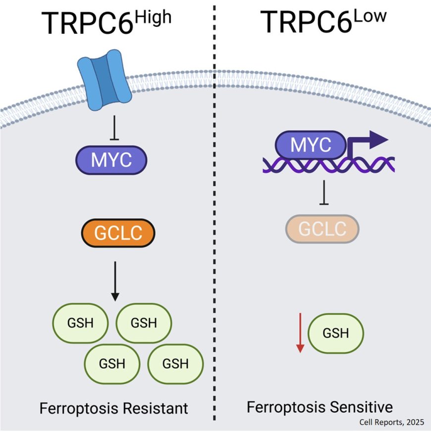 Inducing ferroptosis to impede metastasis by inhibiting the calcium channel TRPC6