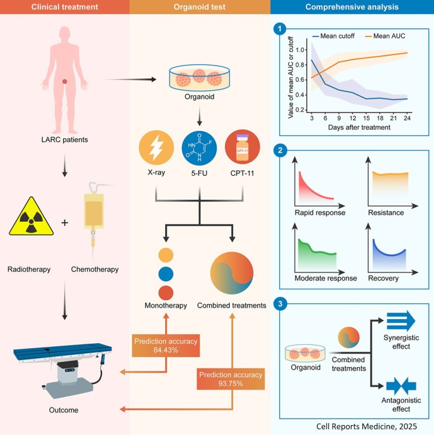 Comprehensive dissection of rectal cancer organoids in responses to chemoradiation