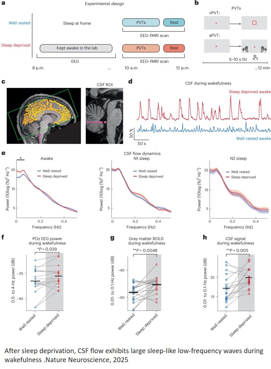 Brain without sleep!
