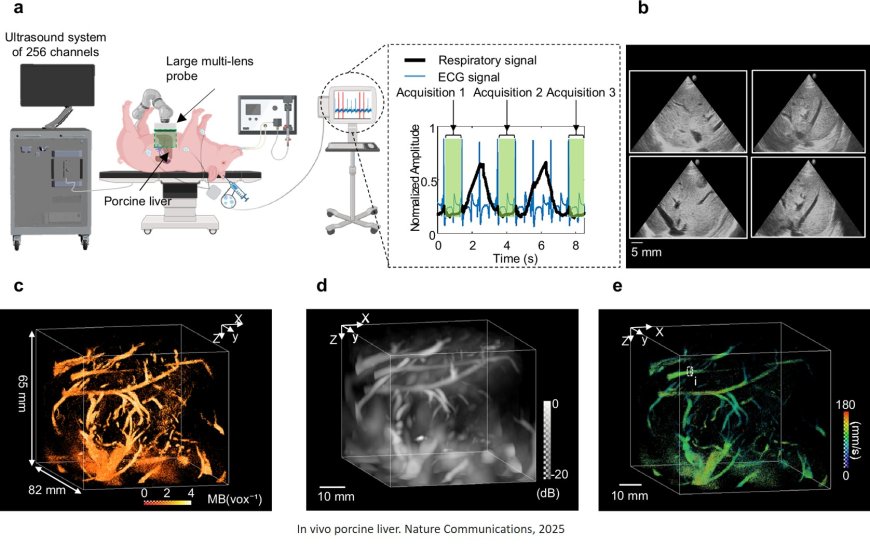 Imaging microvasculature of an entire organ using ultrasound in 4D