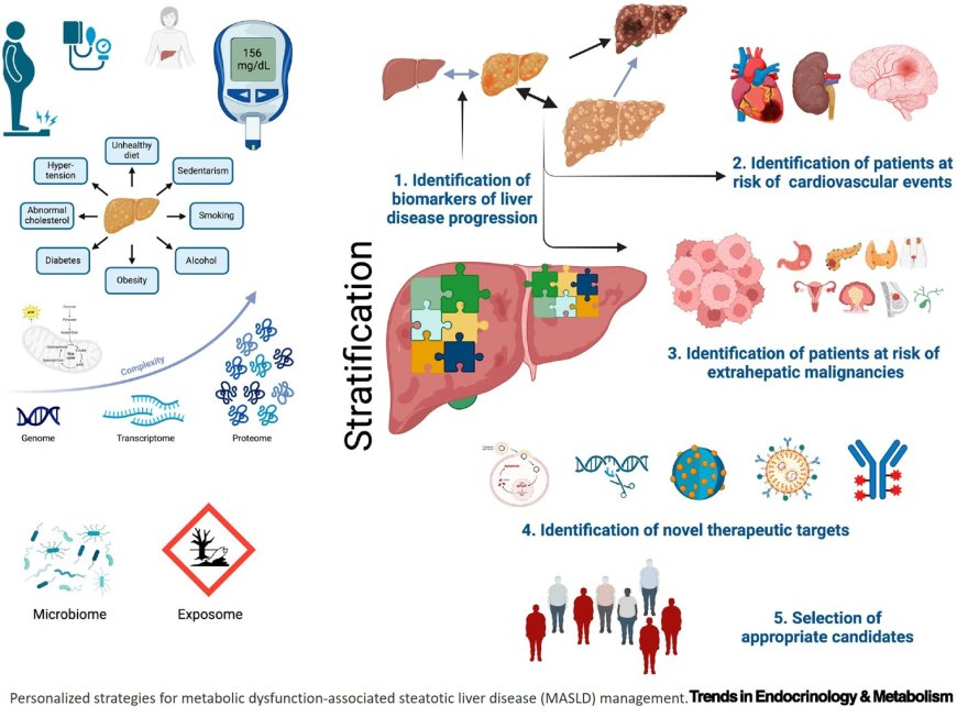 Advancing precision medicine in metabolic dysfunction-associated steatotic liver disease