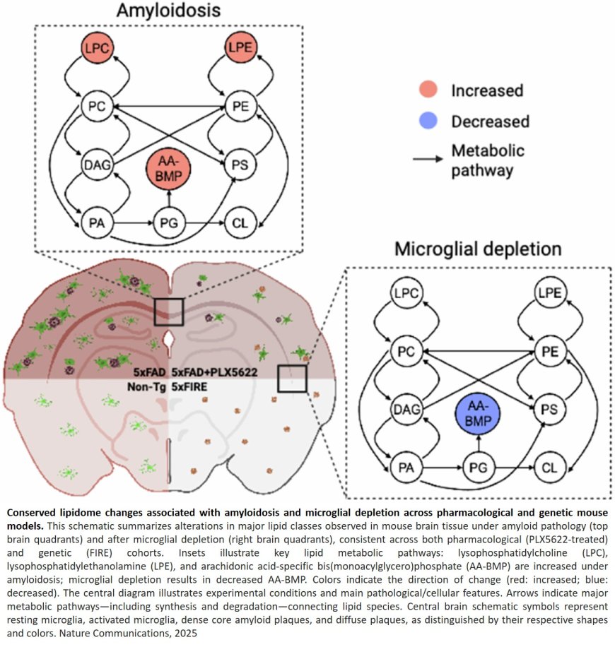 Targeting brain immune cells could restore Alzheimer’s-related lipid imbalance