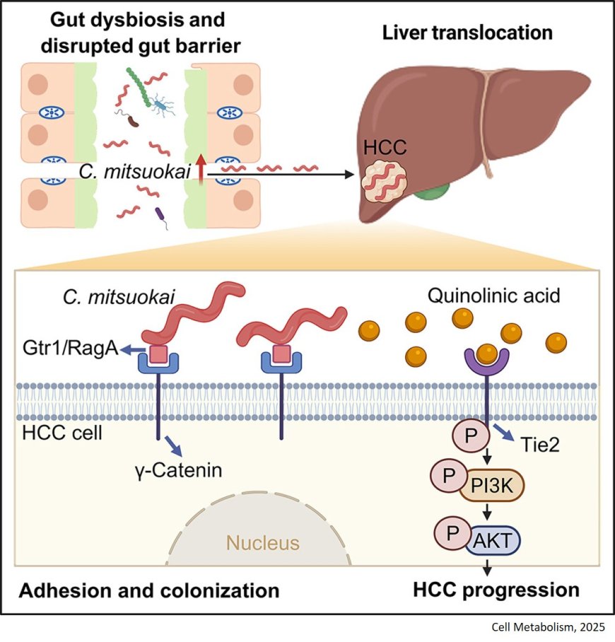 Catenibacterium mitsuokai promotes hepatocellular carcinogenesis by binding to hepatocytes and generating quinolinic acid