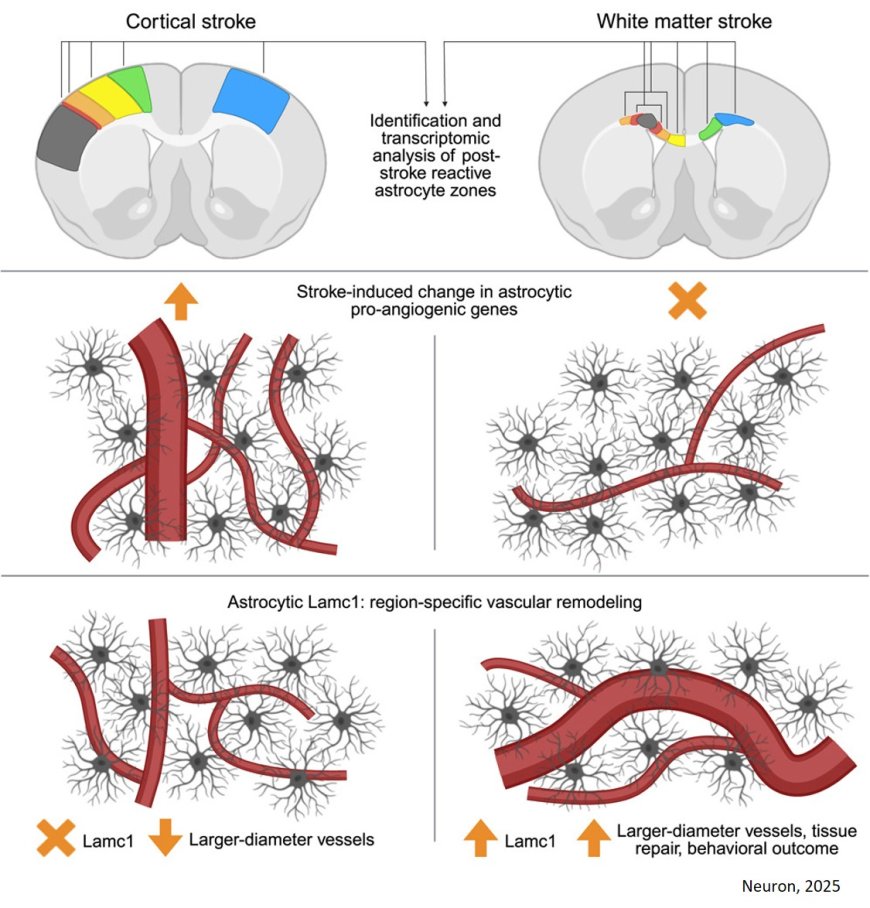 Post stroke differential roles of astrocyte-induced vascular remodeling