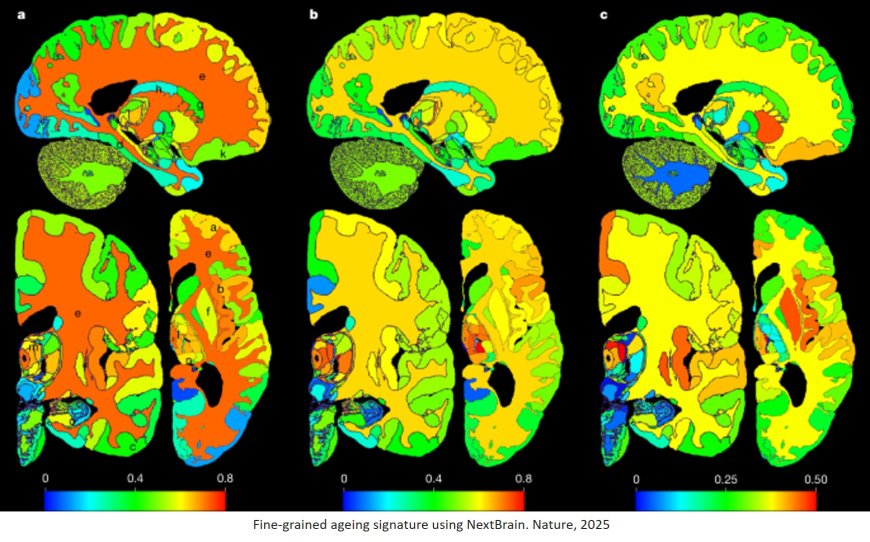 A probabilistic histological atlas of the human brain for MRI segmentation