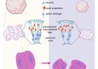 Cellular mechanism underlying microcephaly