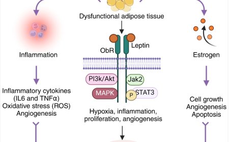 The interplay between endometriosis and obesity