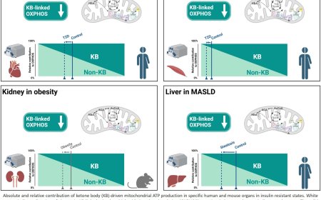 Impaired mitochondrial ketone body oxidation in insulin resistant states