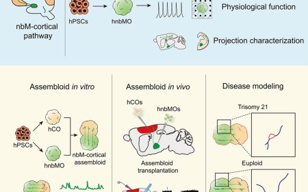 Generation of human nucleus basalis organoids with functional nbM-cortical cholinergic projections in transplanted assembloids