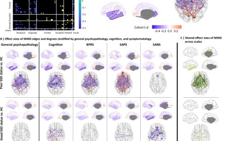 Reduced brain structural similarity is associated with maturation, neurobiological features, and clinical status in schizophrenia