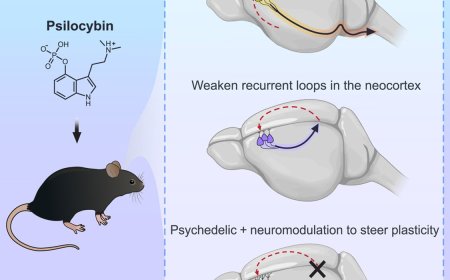 Activity-dependent rewiring of large-scale cortical networks by psilocybin