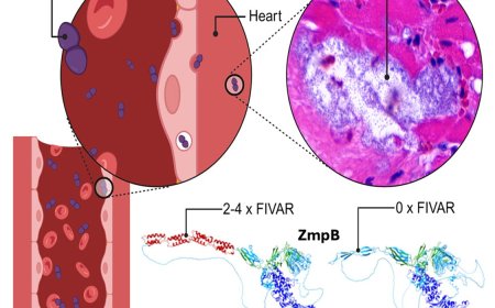 Bacterial enzyme causing fatal heart conditions with pneumonia infections identified!
