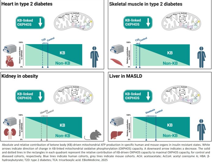 Mitochondrial ketone body oxidation impaired in diabetes & liver disease