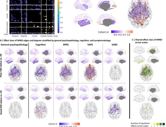 The most affected regions of the brain identified in patients in early stages of schizophrenia spectrum disorders
