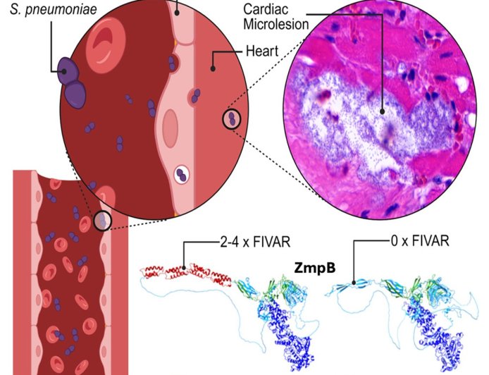 Bacterial enzyme causing fatal heart conditions with pneumonia infections identified!