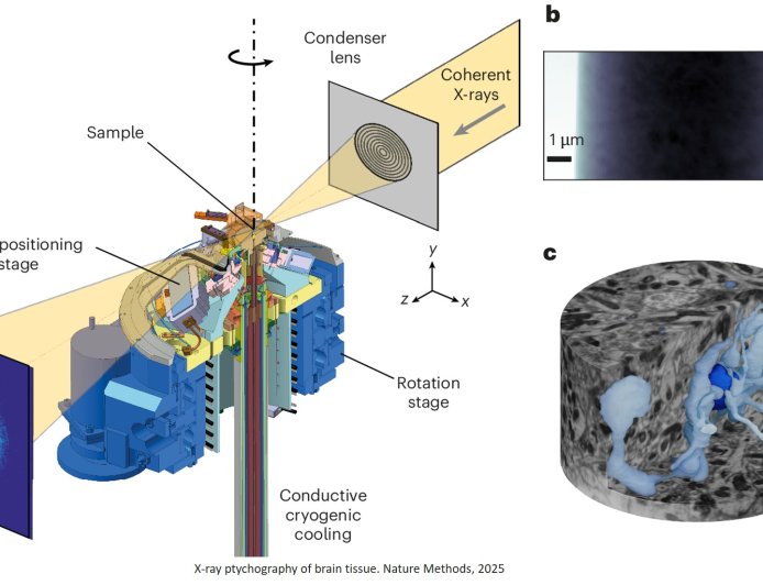 High-resolution brain mapping using X-ray ptychography