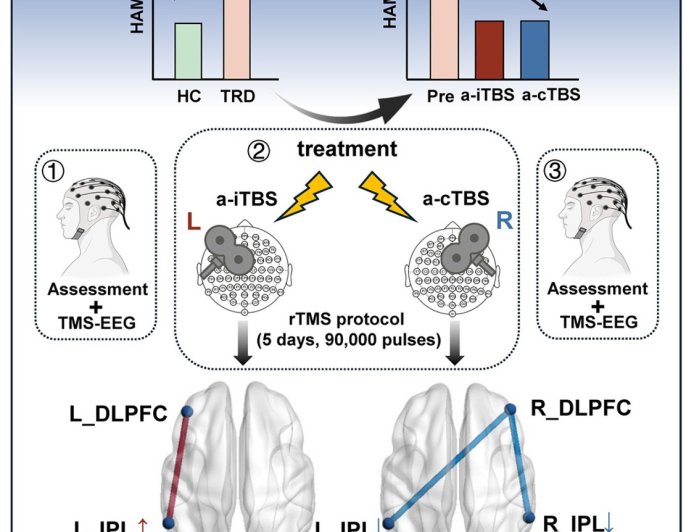 Frontoparietal network mediates the antidepressant effects of accelerated iTBS and cTBS: TMS-EEG study