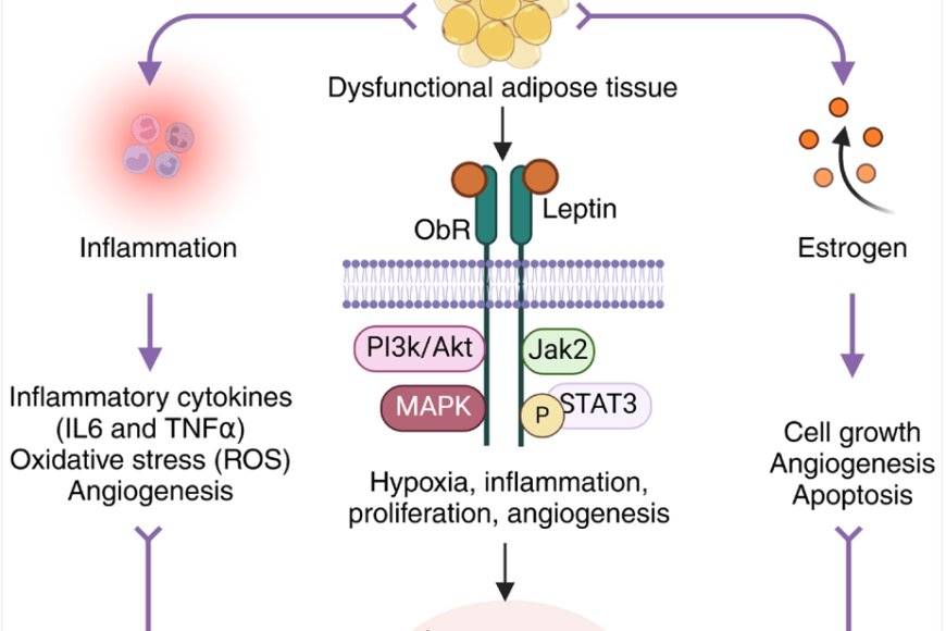 Endometriosis and obesity interplay!