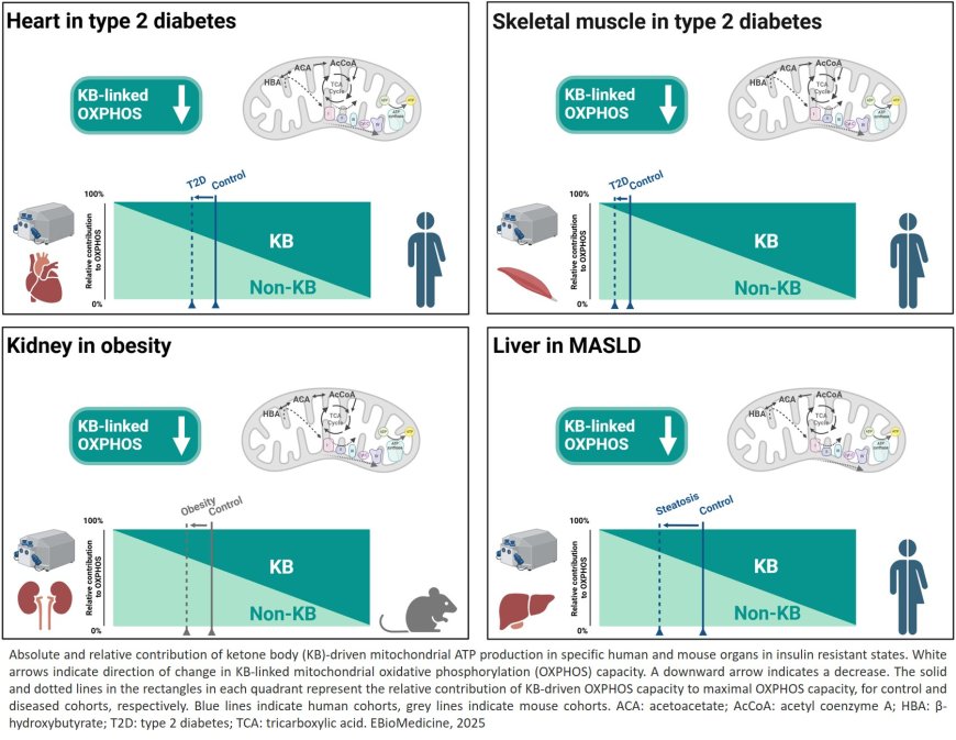 Impaired mitochondrial ketone body oxidation in insulin resistant states