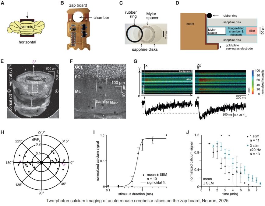 Ultrastructural membrane dynamics of mouse and human cortical synapses