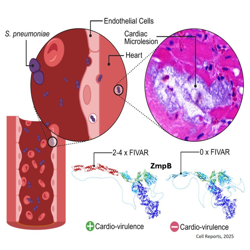 Allele-specific zinc metalloprotease B influences cardiac damage during invasive pneumococcal disease