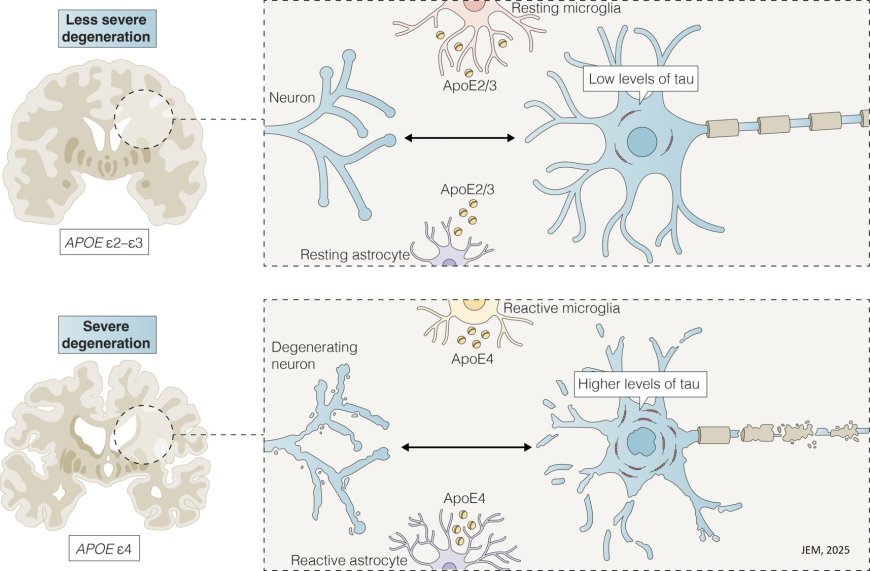ApoE-calypse tau: ApoE–tau synergy in Alzheimer’s disease