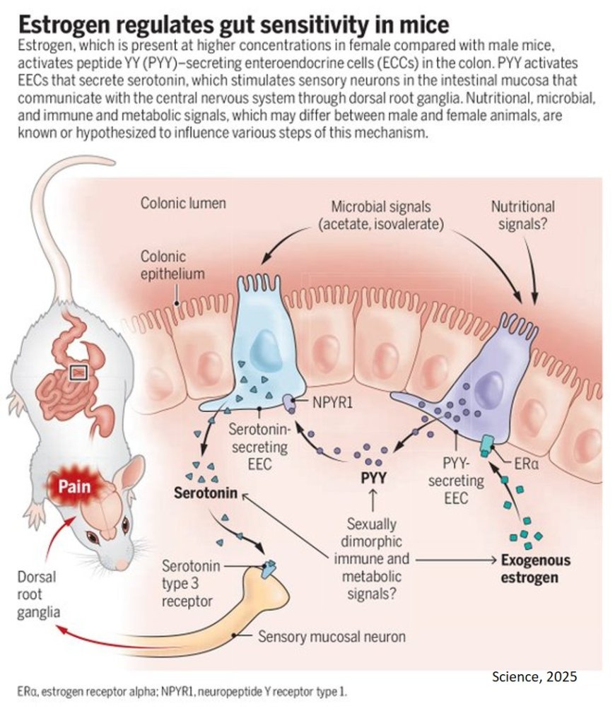 Do hormones explain why women experience more gut pain?