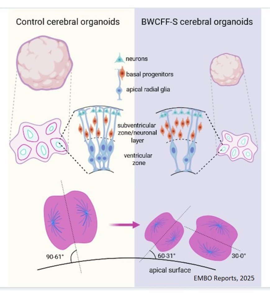 Cellular mechanism underlying microcephaly