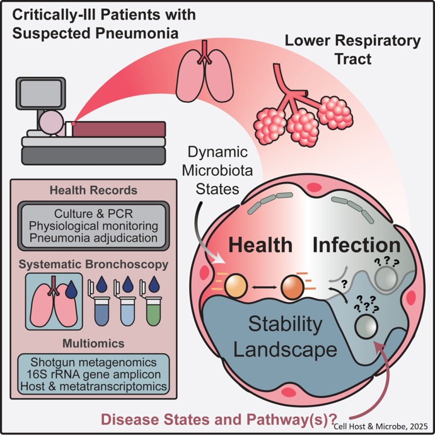 Microbial communities in lungs linked to pneumonia recovery