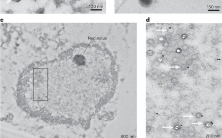 Phosphorylation of tau inhibits HSV-1 infection