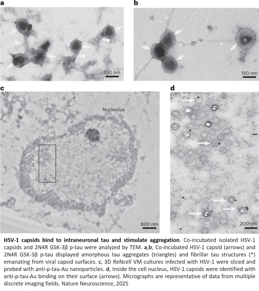 Phosphorylated tau exhibits antimicrobial activity capable of neutralizing herpes simplex virus 1 infectivity in human neurons